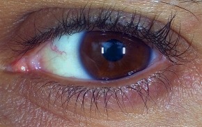 My Left Eye 100_0002c
